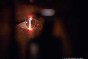 Augen lasern lassen: Wie läuft die Behandlung ab?